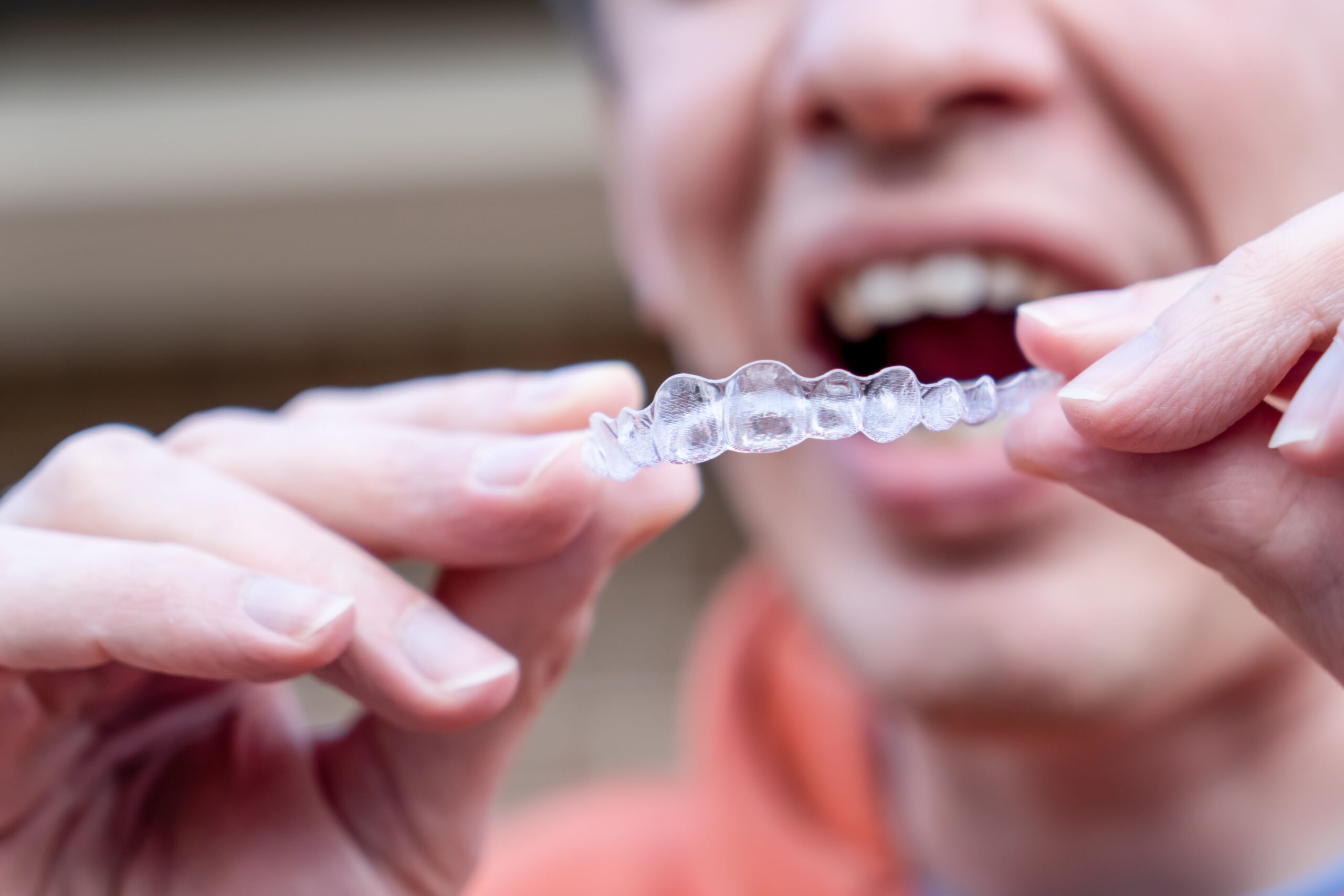 Person holding Invisalign clear aligners
